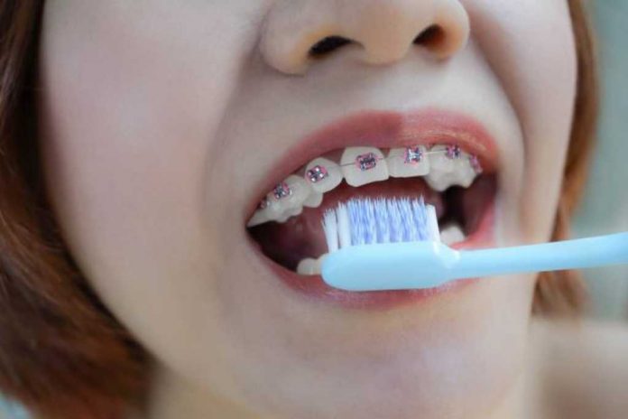 menyikat gigi behel secara teratur